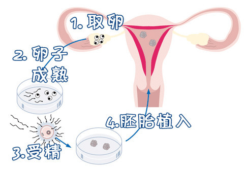 针灸